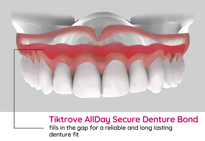 TIKTROVE AllDay Secure Denture Bond