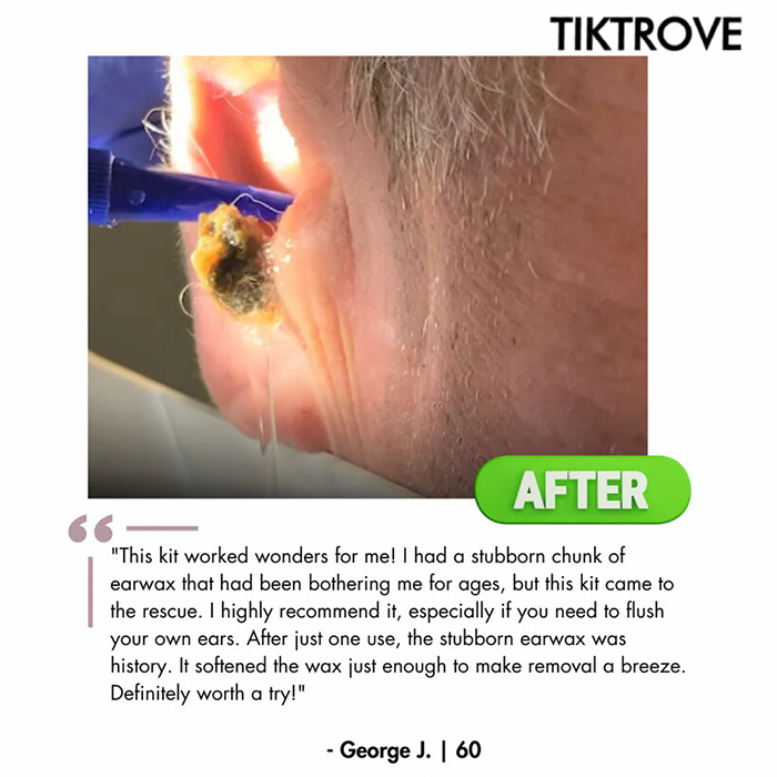 Tiktrove Electric Ear Wax Removal Kit