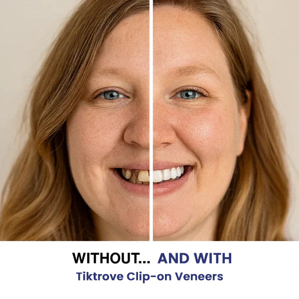 Tiktrove Clip-on Veneers