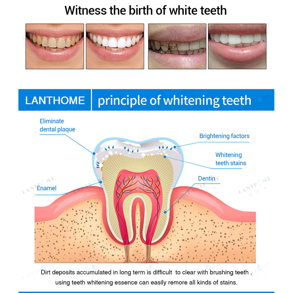 Teeth Whitening Essence
