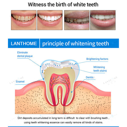 Teeth Whitening Essence