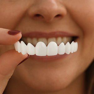 Tiktrove Clip-on Veneers