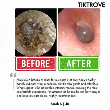 Tiktrove Electric Ear Wax Removal Kit