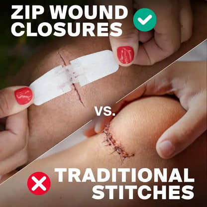 ⏰? Zip-Stitch Wound Closure Kit（1 Set 3 Pcs）