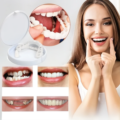 Tiktrove Clip-on Veneers
