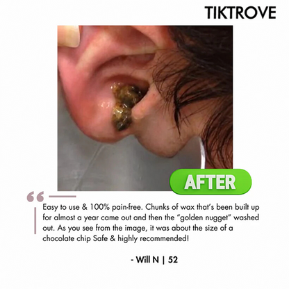 Tiktrove Electric Ear Wax Removal Kit