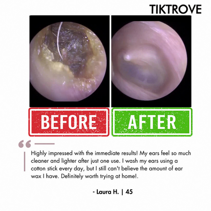 Tiktrove Electric Ear Wax Removal Kit