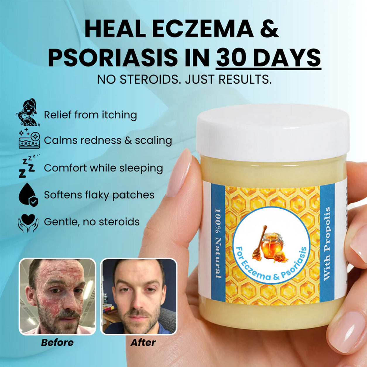 Repair Balm For Eczema & Psoriasis