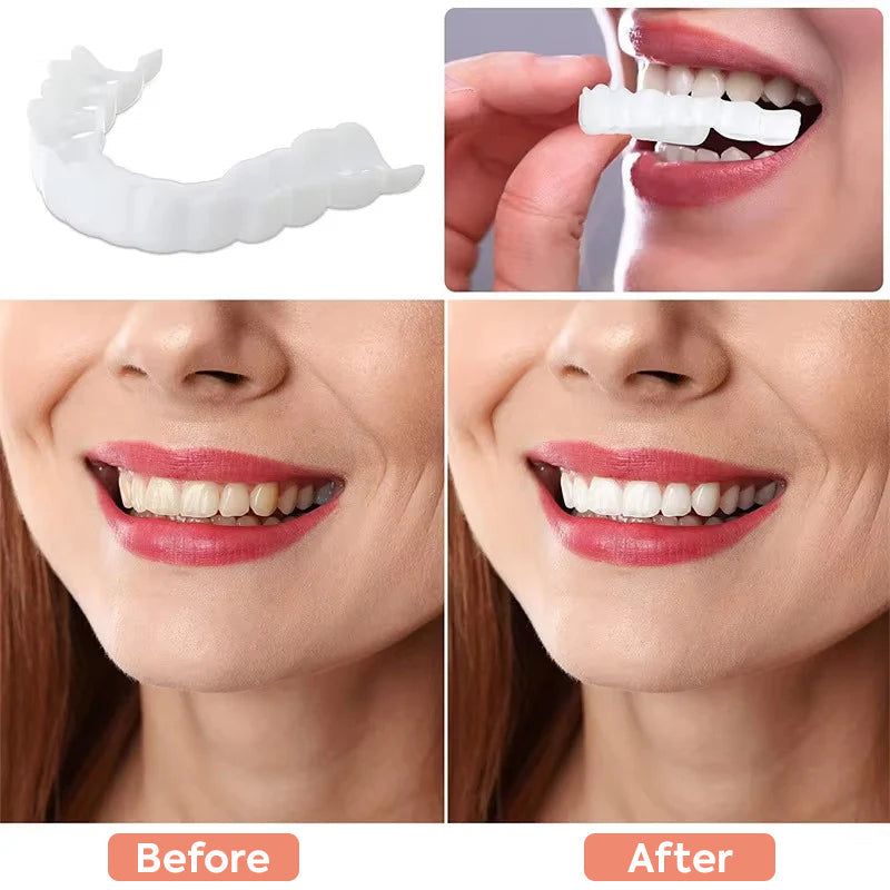 Tiktrove Clip-on Veneers