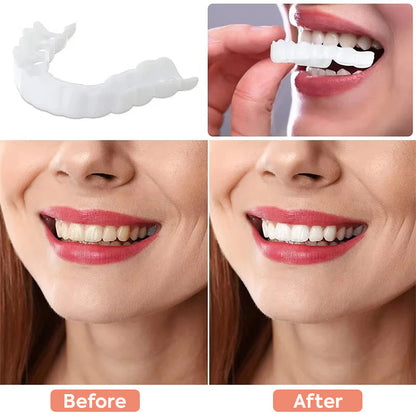 Tiktrove Clip-on Veneers