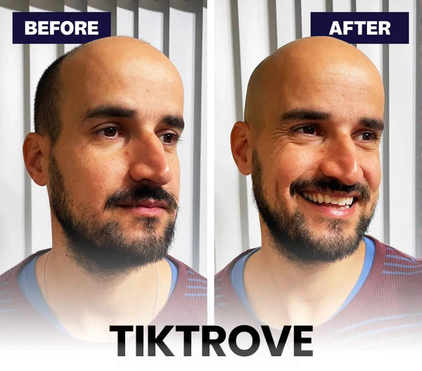 Tiktrove 9.0 ULTRA