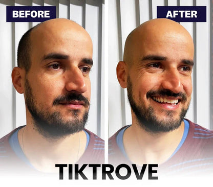 Tiktrove 9.0 ULTRA