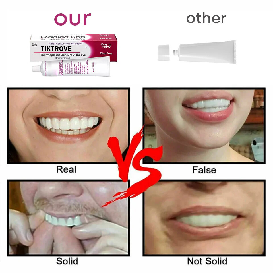 Thermoplastic Denture Adhesive ✨🎁