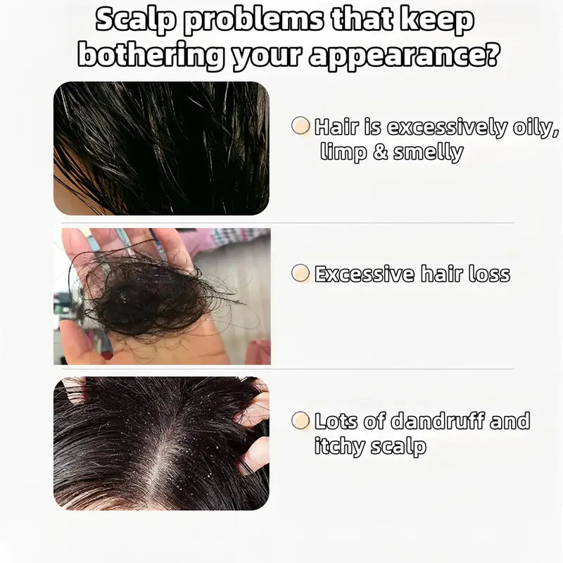 Anti-Hair Fall Hair Loss Treatment Shampoo Oil
