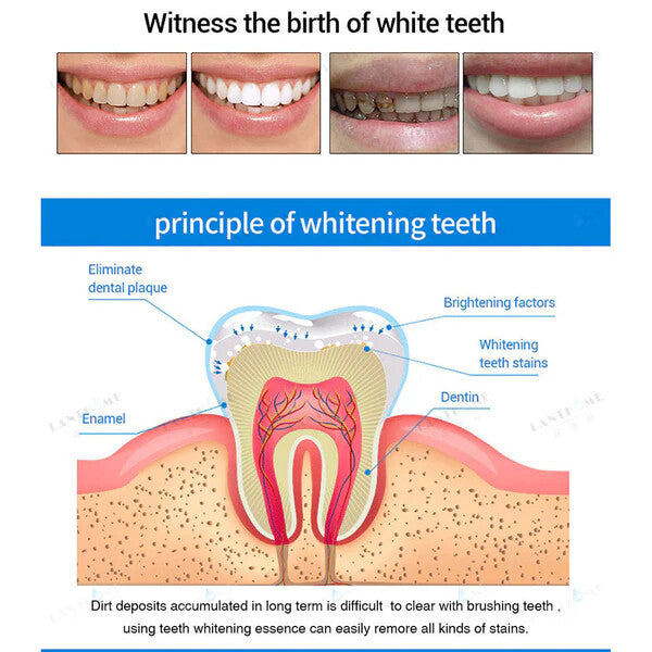 Teeth Whitening Essence