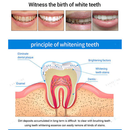 Teeth Whitening Essence
