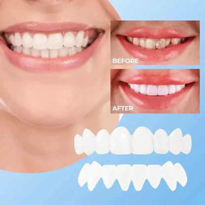 Tiktrove Clip-on Veneers