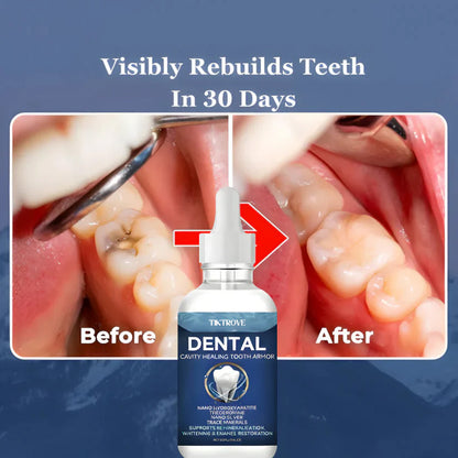 Tiktrove Tooth Armor