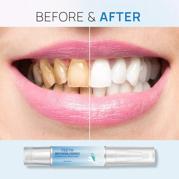 Teeth Whitening Essence
