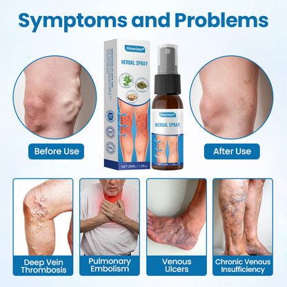 VeinGuard Herbal Spray – Clinically Proven to Diminish Varicose Veins in Just 7 Days