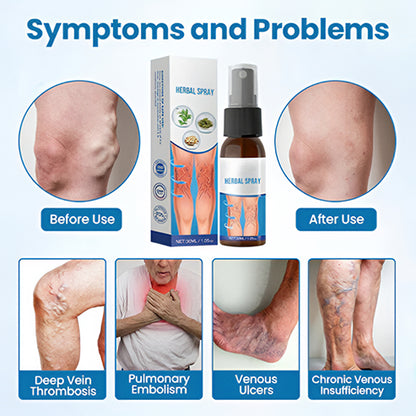 VeinGuard Herbal Spray – Clinically Proven to Diminish Varicose Veins in Just 7 Days