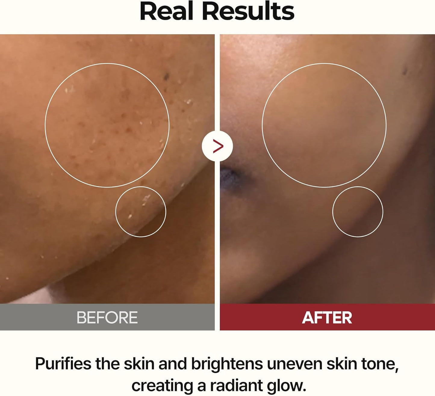 Peel Shot Glow Rice Ampoule Duo