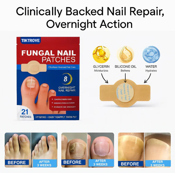 Tiktrove Fungal Nail Renewal Patches