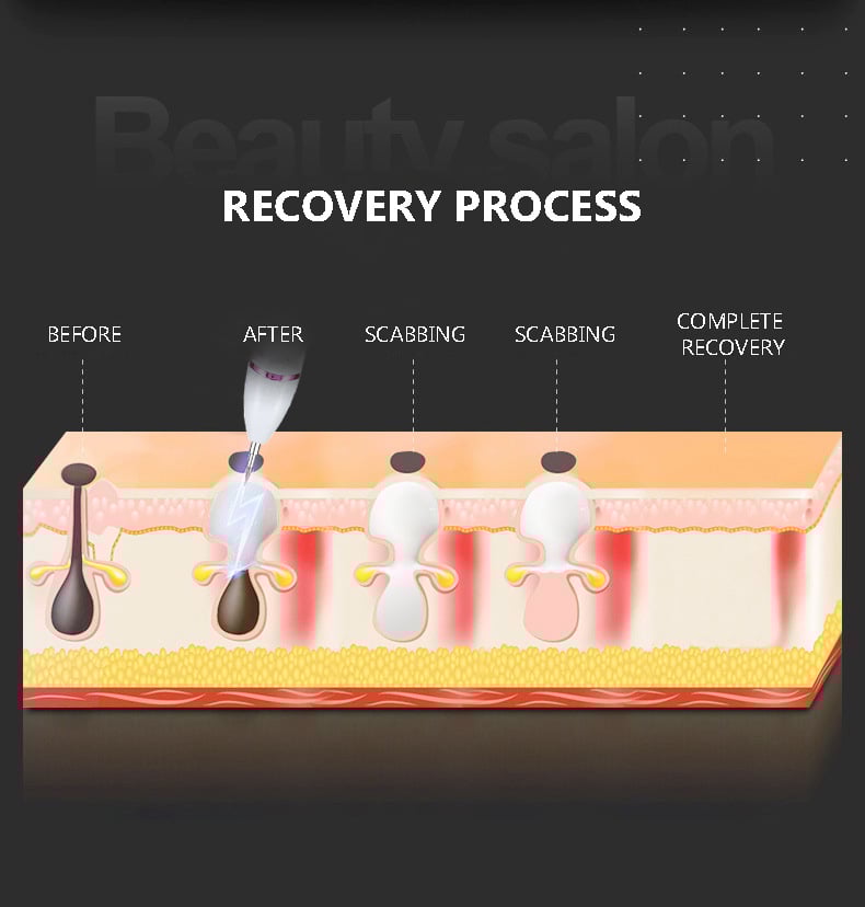 🔥New Beauty Technologies——LCD Beauty Pen