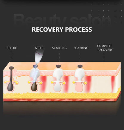 🔥New Beauty Technologies——LCD Beauty Pen