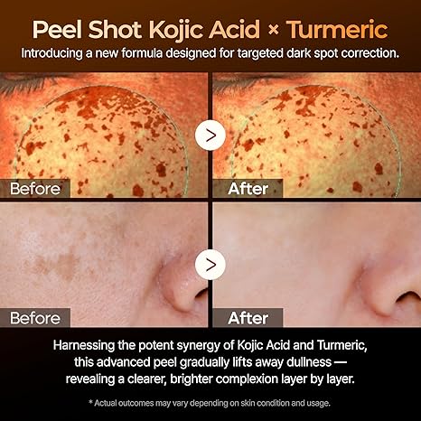 Peel Shot Glow Rice Ampoule Duo