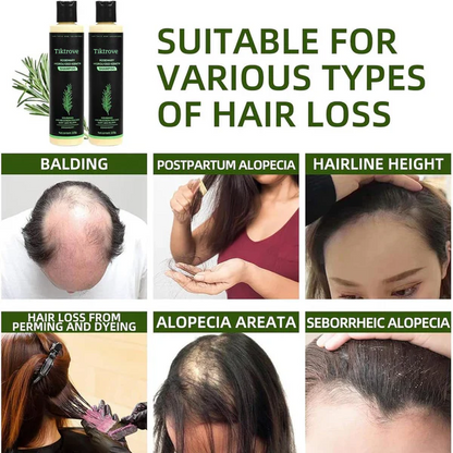 Tiktrove Rosemary Shampoo