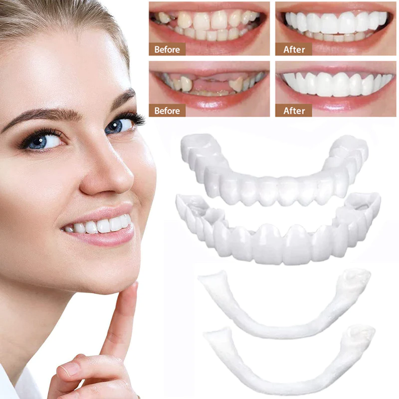 Tiktrove Clip-on Veneers