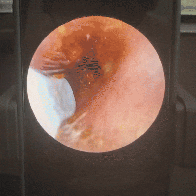 Tiktrove: Doctor Approved Ear Health Technology