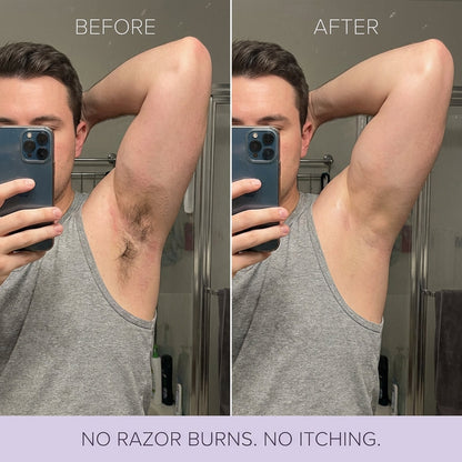 Tiktrove Hair Removal Mousse