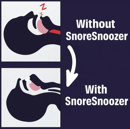 SnoreSnoozer Pro - Instant Snoring Relief