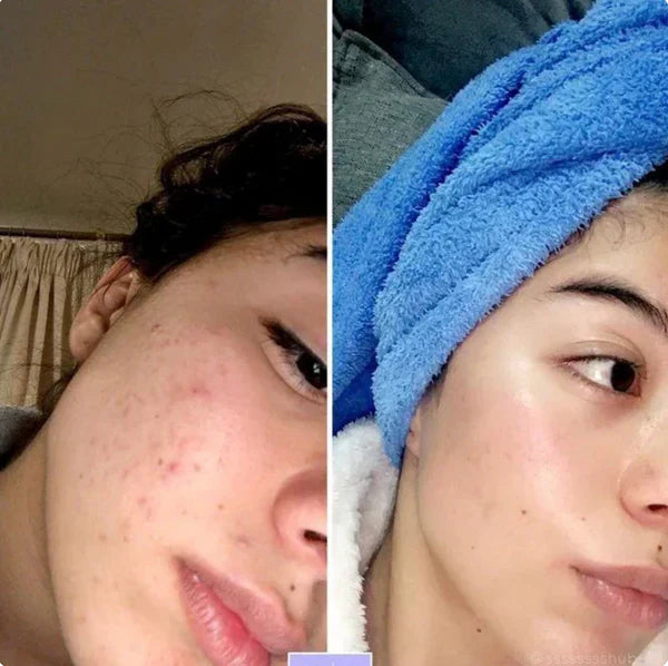 Radiant Blowout Routine Set | Dark Spot & Peeling Care