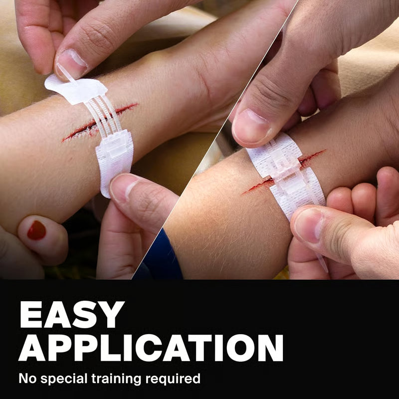 ⏰? Zip-Stitch Wound Closure Kit（1 Set 3 Pcs）