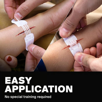 ⏰? Zip-Stitch Wound Closure Kit（1 Set 3 Pcs）