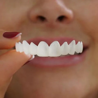 Tiktrove Clip-on Veneers